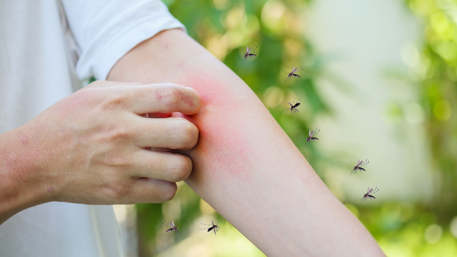Mosquito Control for Families in Topsfield: Safe, Long-Lasting Solutions